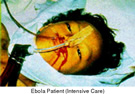 MISC_Ebola_Patient.jpg